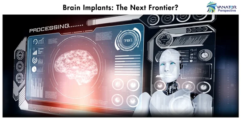 Brain Implants: The Next Frontier? - AI in Workplace: Impact, Concerns, Learning, and Advice